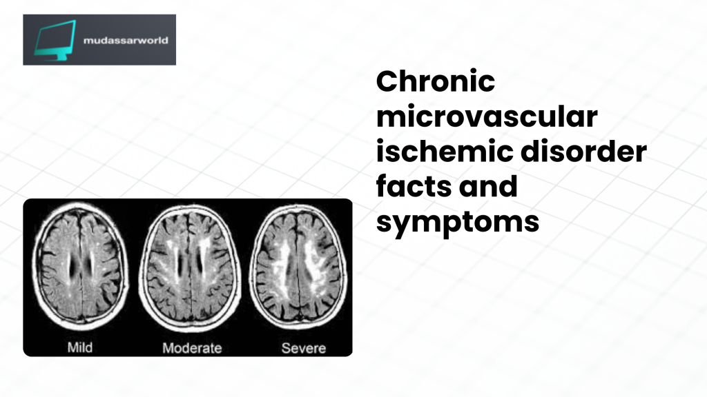 Chronic microvascular ischemic disorder disease facts and symptoms treat prevention